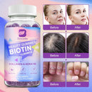 BEWORTHS Biotin Gummies 12000mcg with Biotin, Collagen, Keratin, Chlorophyll, Zinc and Vitamin A, B6, B12, C, D, E Complex Supports Hair Skin and Nails Growth for Women & Men